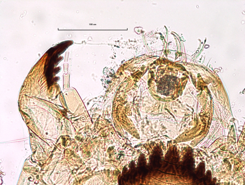 photomicrograph of a chironomid midge larva showing an antenna with about five segments and a ring organ on the first segment. Also visible are the mandible, premandibles, labrum, and mentum.
