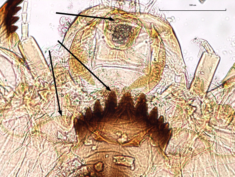 photomicrograph of the mouthparts of a chironomid midge larva with arrows pointing to the pecten epipharyngis with about 5 broad teeth, the mentum slightly out of focus, and the ventromental plate, which is lined and has a wavy edge and is about 2/3 the width of the mentum.