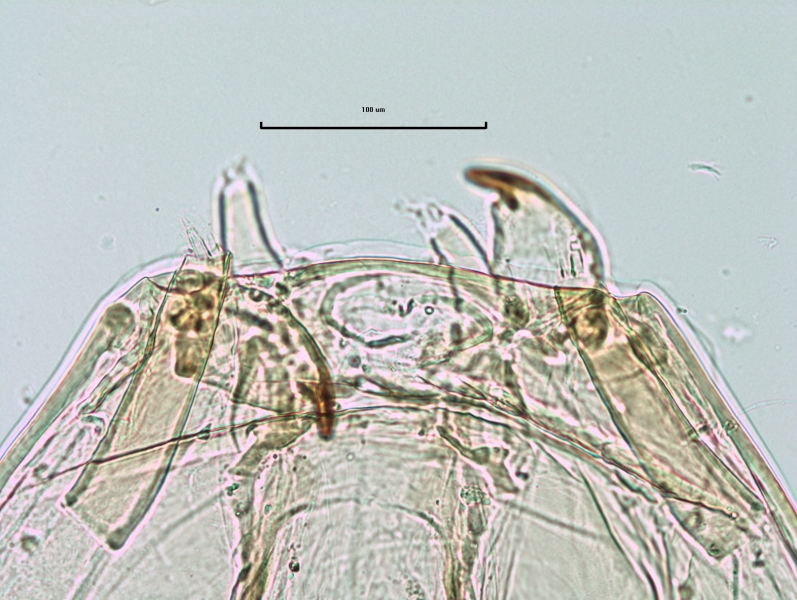 photomicrograph of the head capsule of a chironomid midge larva showing the antenna of a chironomid midge larva. Most of the very long first segment is retracted into the head capsule, leaving only a few tiny segments exposed. The mandibles are also visible.