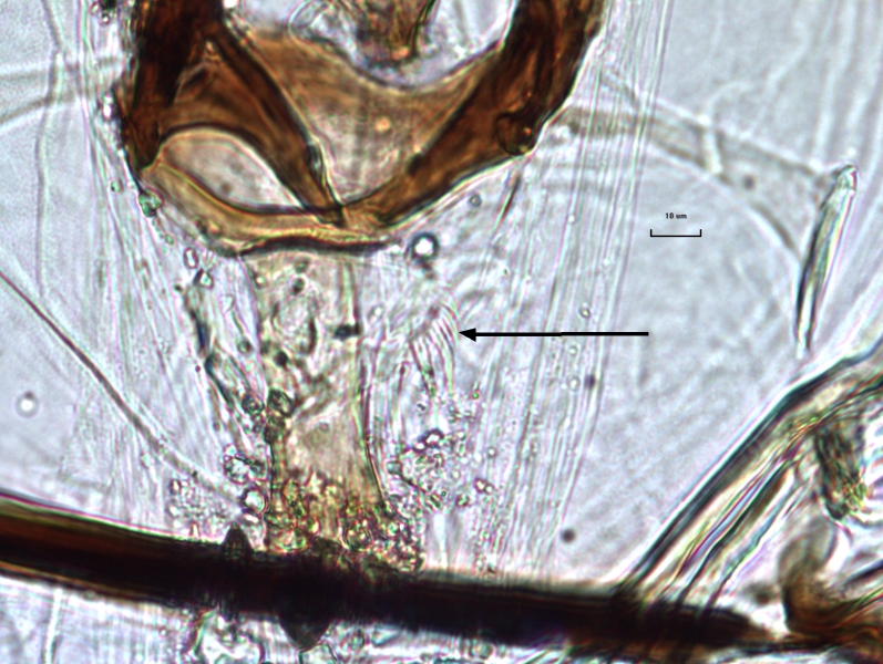 photomicrograph of the mouthparts of a chironomid midge larva, an arrow pointing to the paraligula with many spiky teeth at an angle along the ligula.