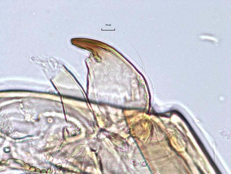 photomicrograph of part of a chironomid midge larva showing a very thick mandible with a single tooth, an antenna, and part of the M appendage looing like teeth