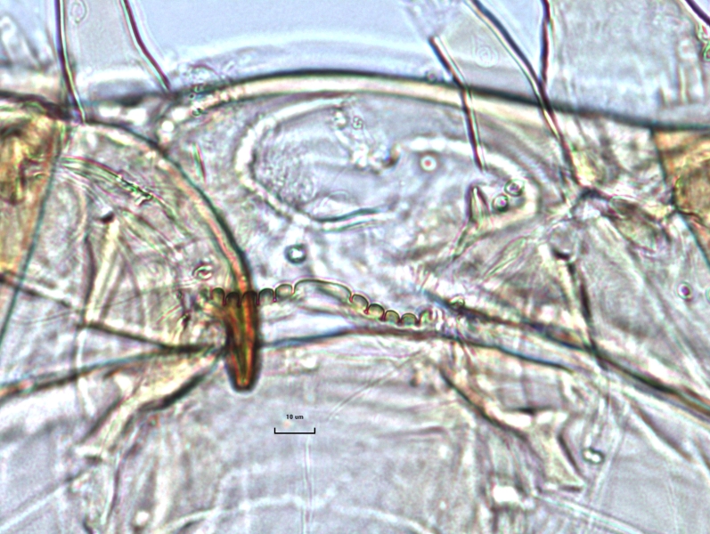 photomicrograph of the mouthparts of a chironomid larvae showing the M appendage with a broad, flat middle tooth and a concave array of 5 rounded dorsomental teeth on either side 