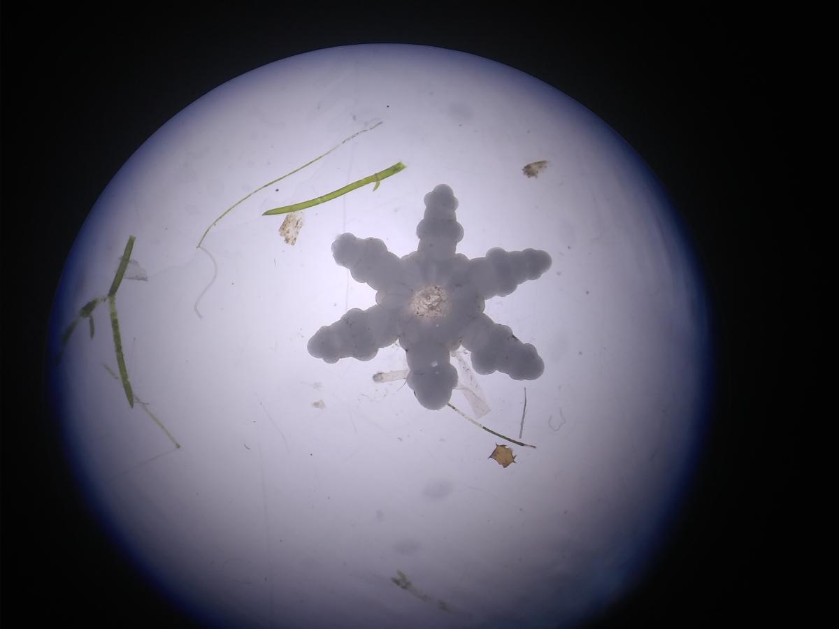 microscope photo of a six-pointed star shaped bulb and some filamentous algae.