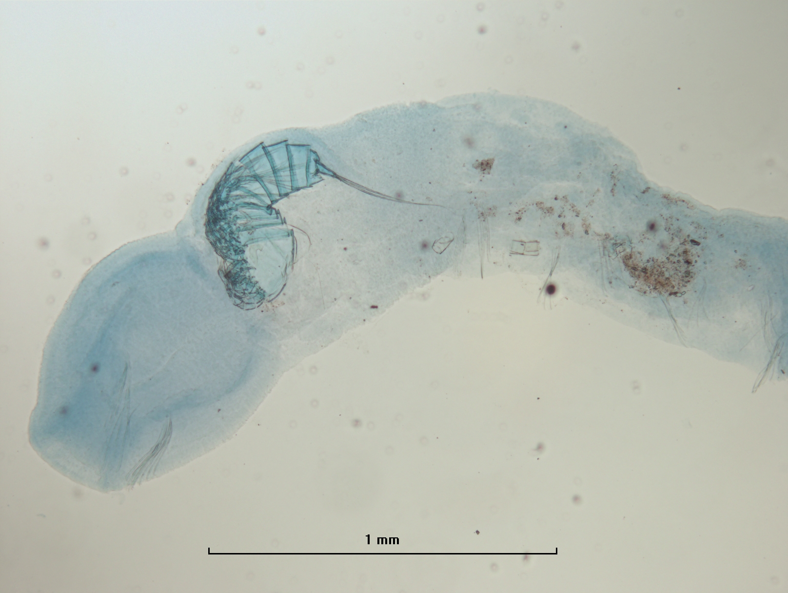 Photomicrograph of a worm with a large mouth, and a small crustacean is inside.