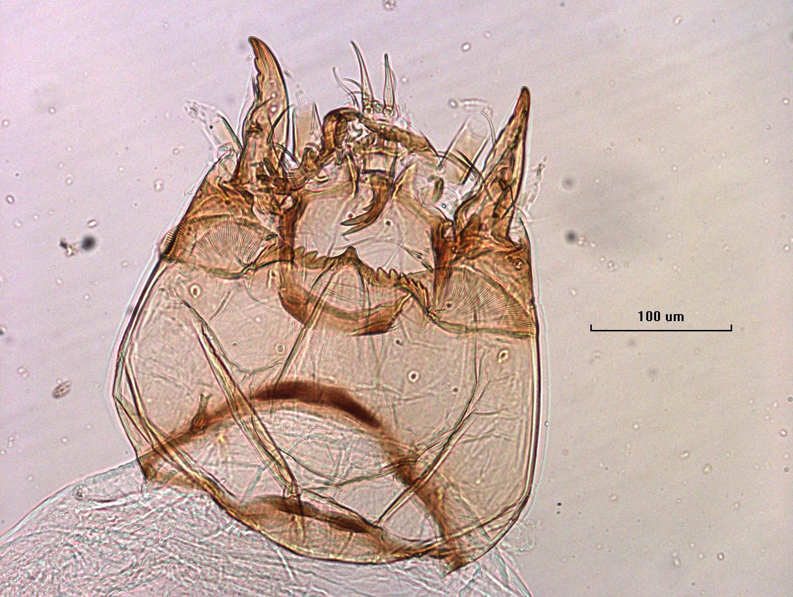 photomicrograph of the head capsule of a chironomid midge larva showing the mentum and ventromental plates