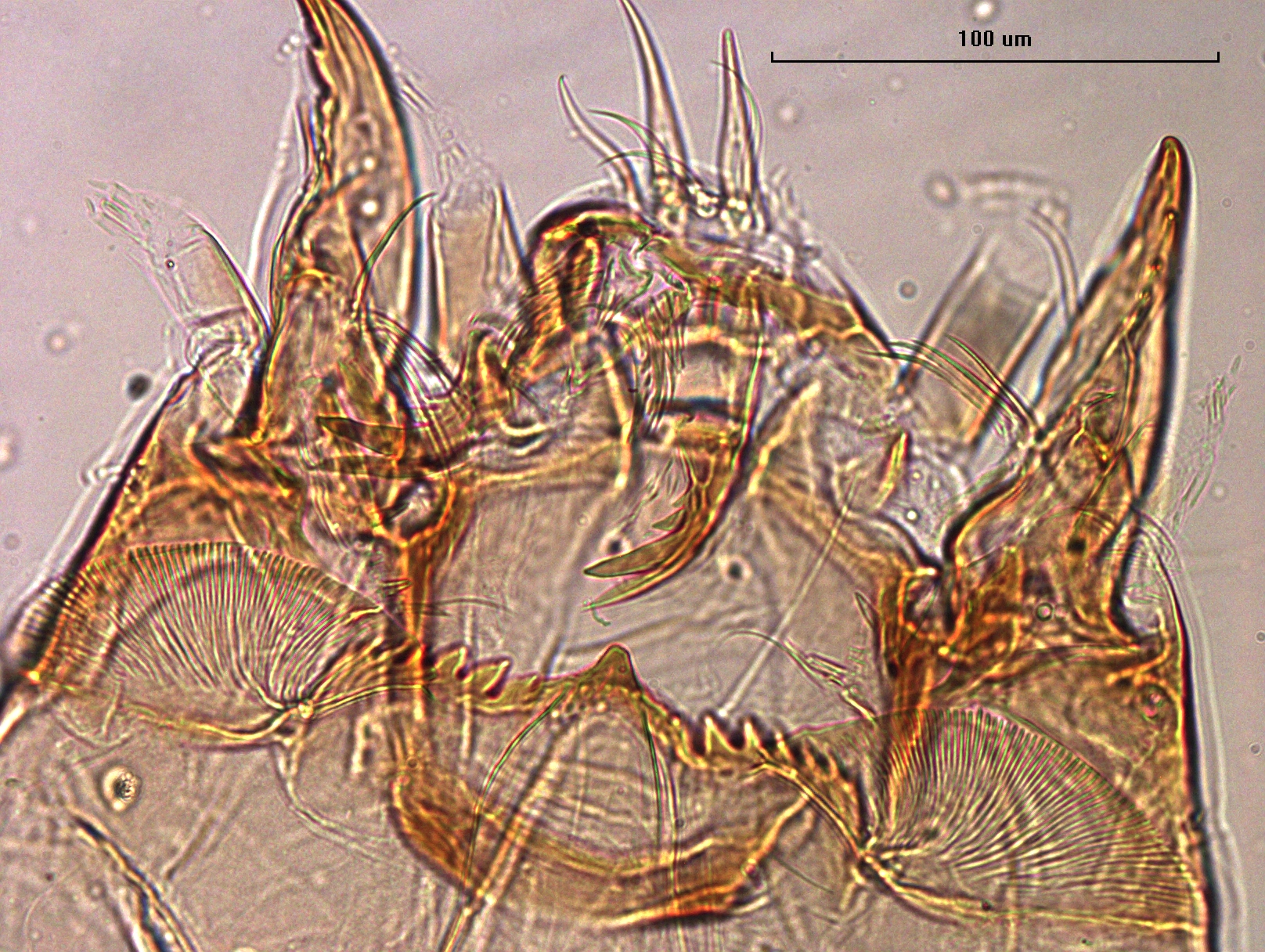 photomicrograph of the head capsule of a chironomid midge larva showing the pectin epiharyngis