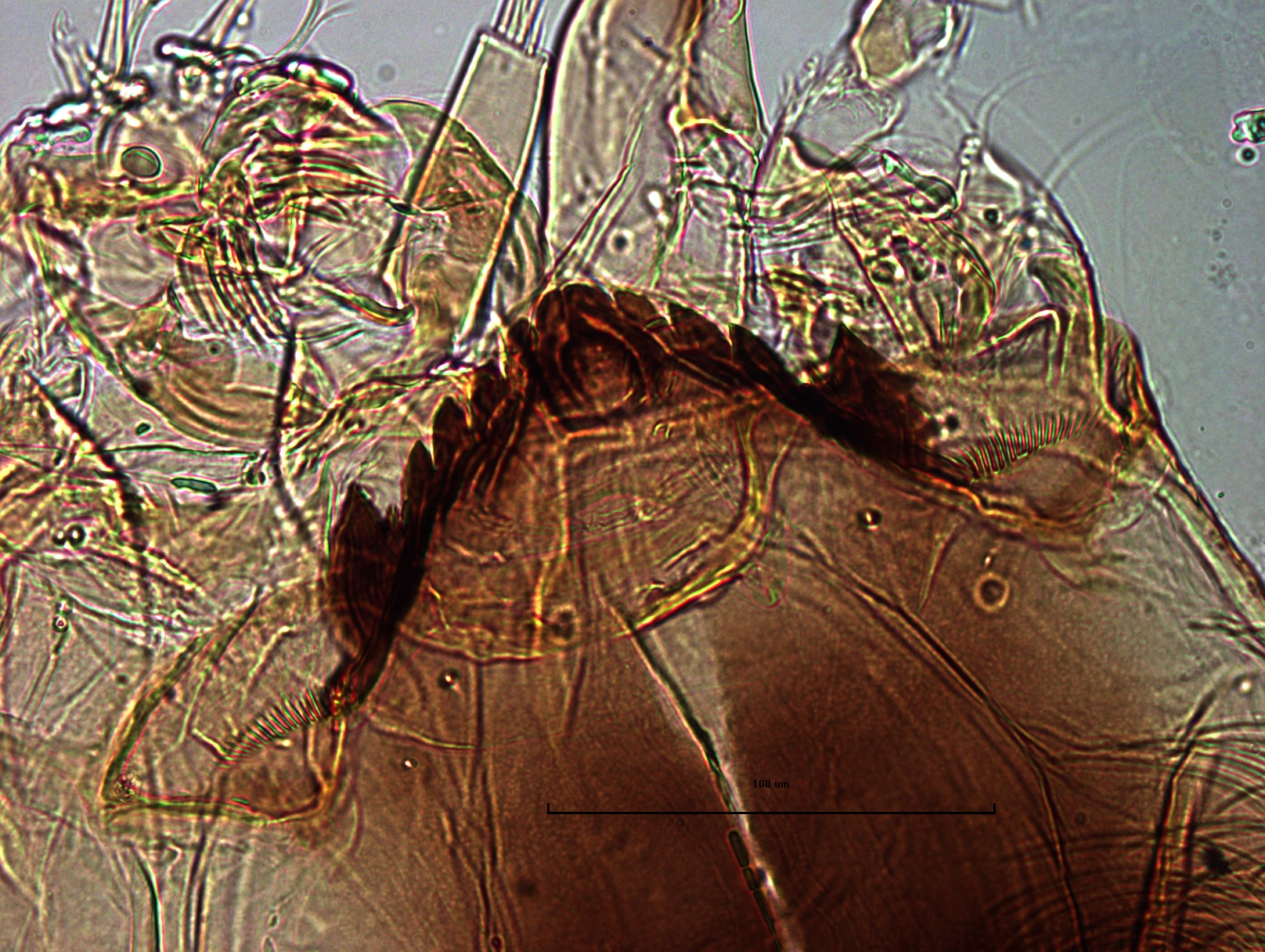 photomicrograph of a chironomid midge larva head capsule showing outer mentum teeth, ventral head portion, and ventromental plates.