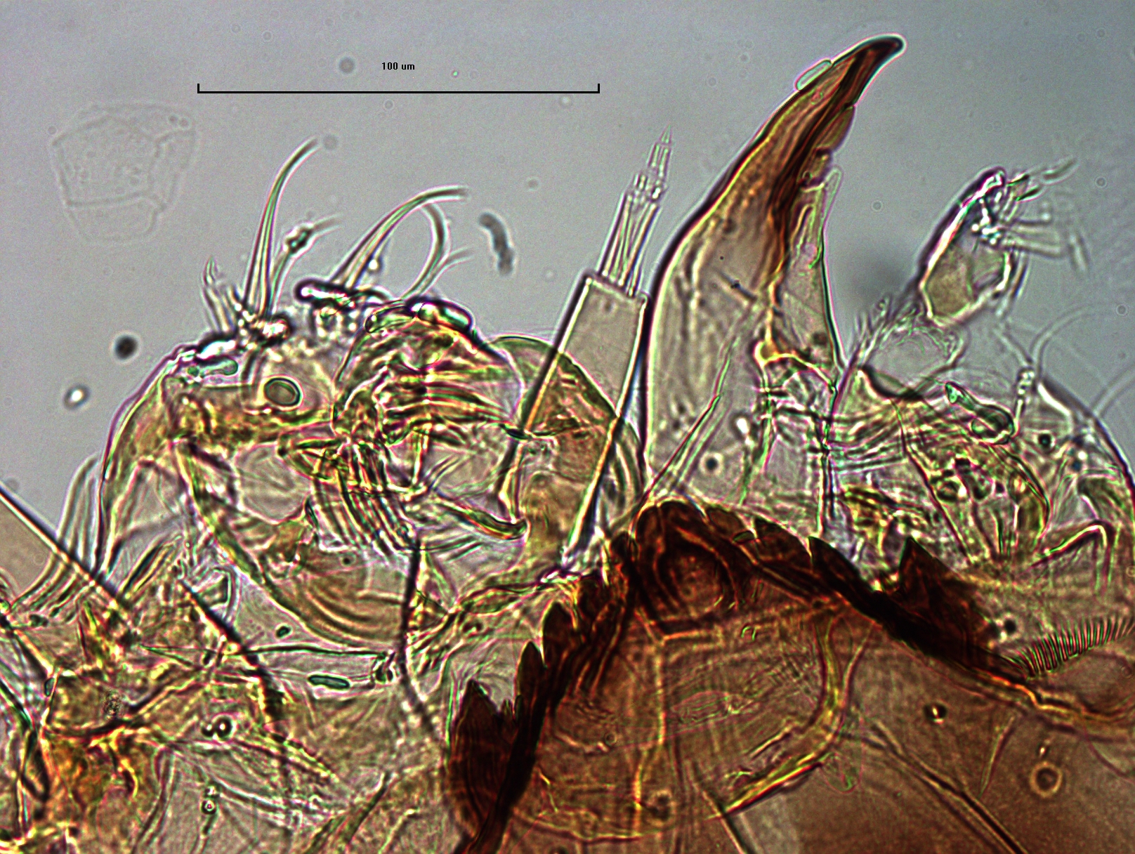 photomicrograph of a chironomid midge larva head capsule showing mandibles, antennae, and premandibles