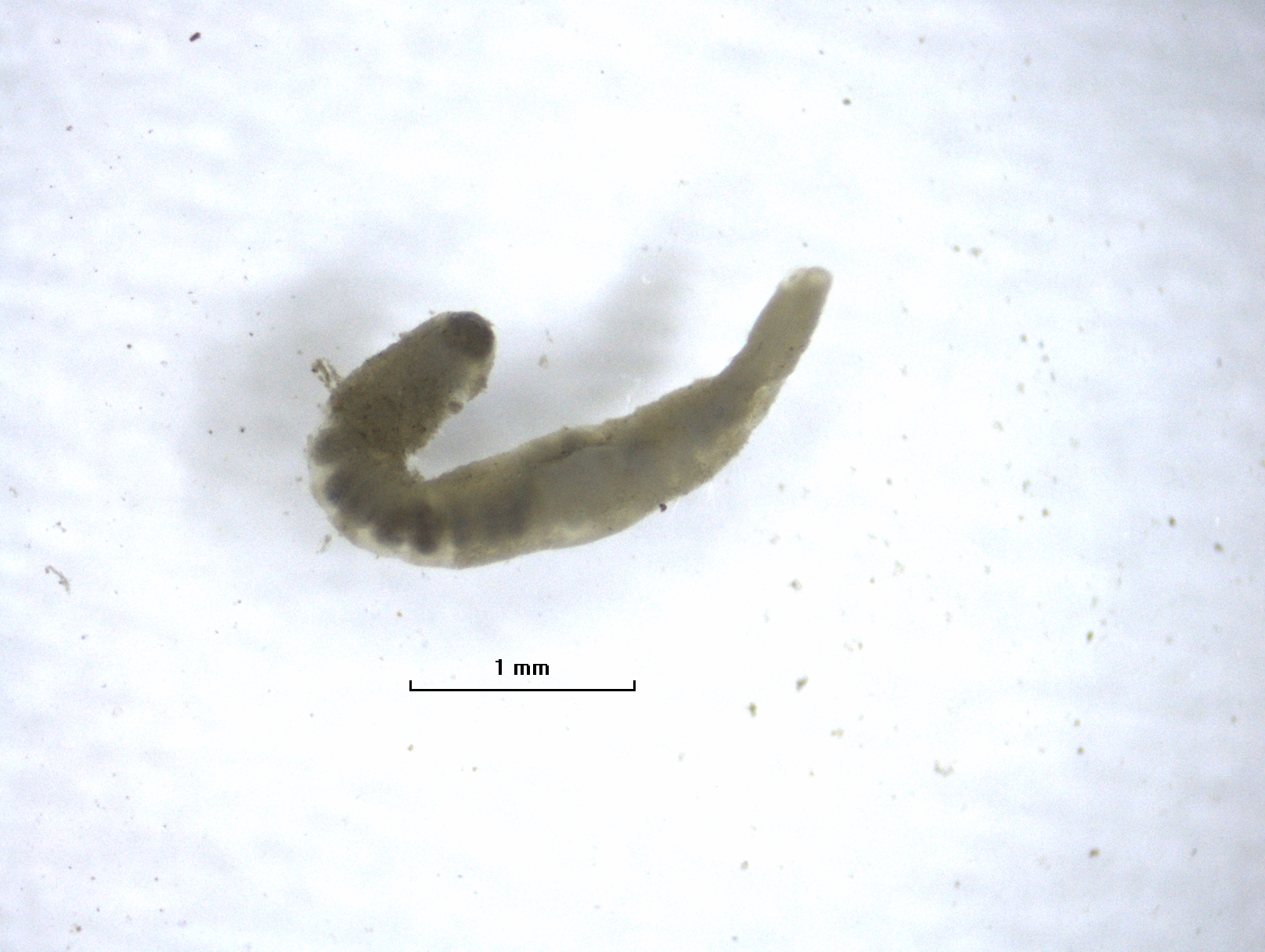 Photomicrograph of a worm with a thickened clitellum