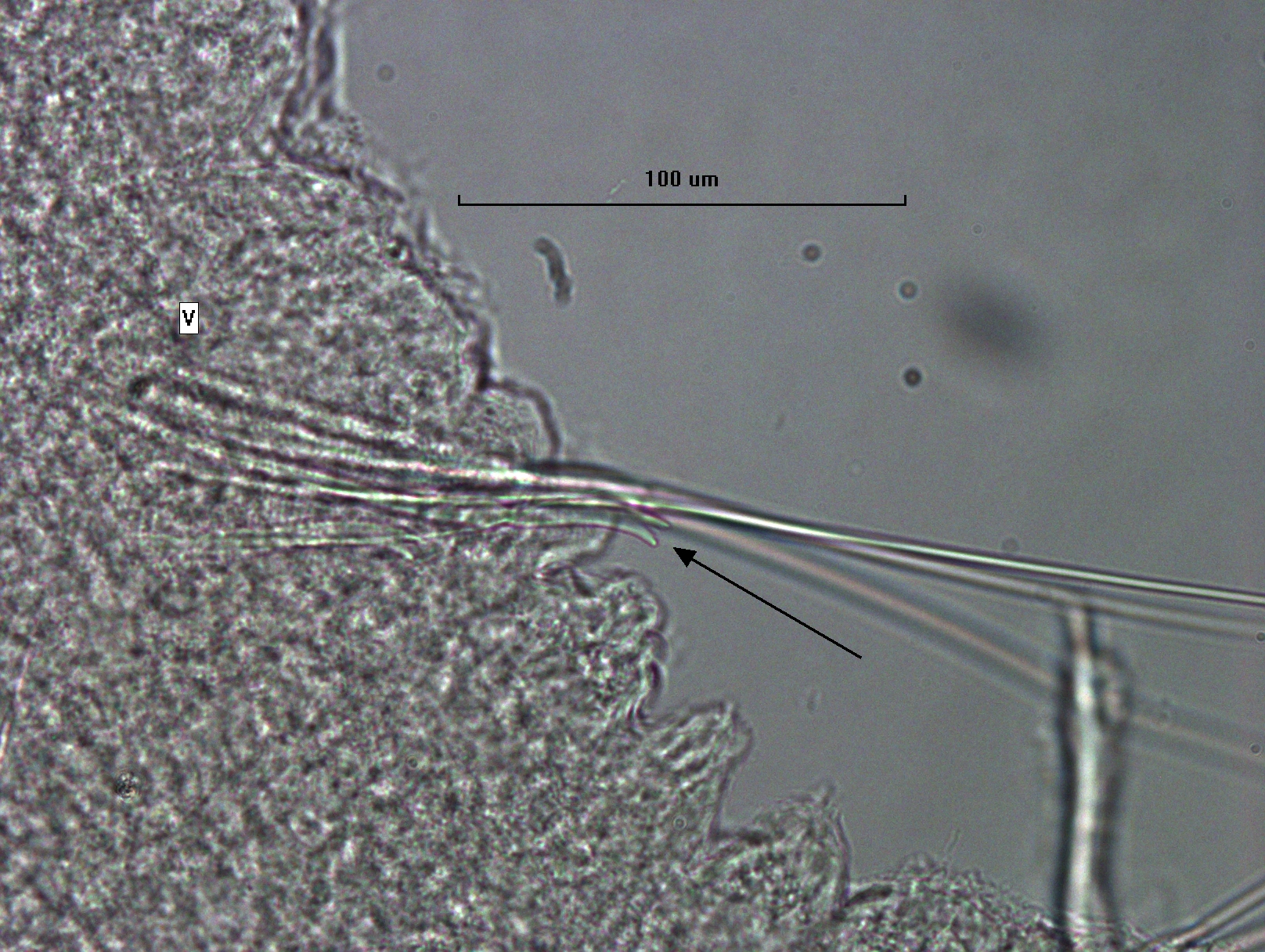Photomicrograph of worm chaetae showing a combination of long thin hairs and chaetae with two large teeth and minute pectinations inbetween.