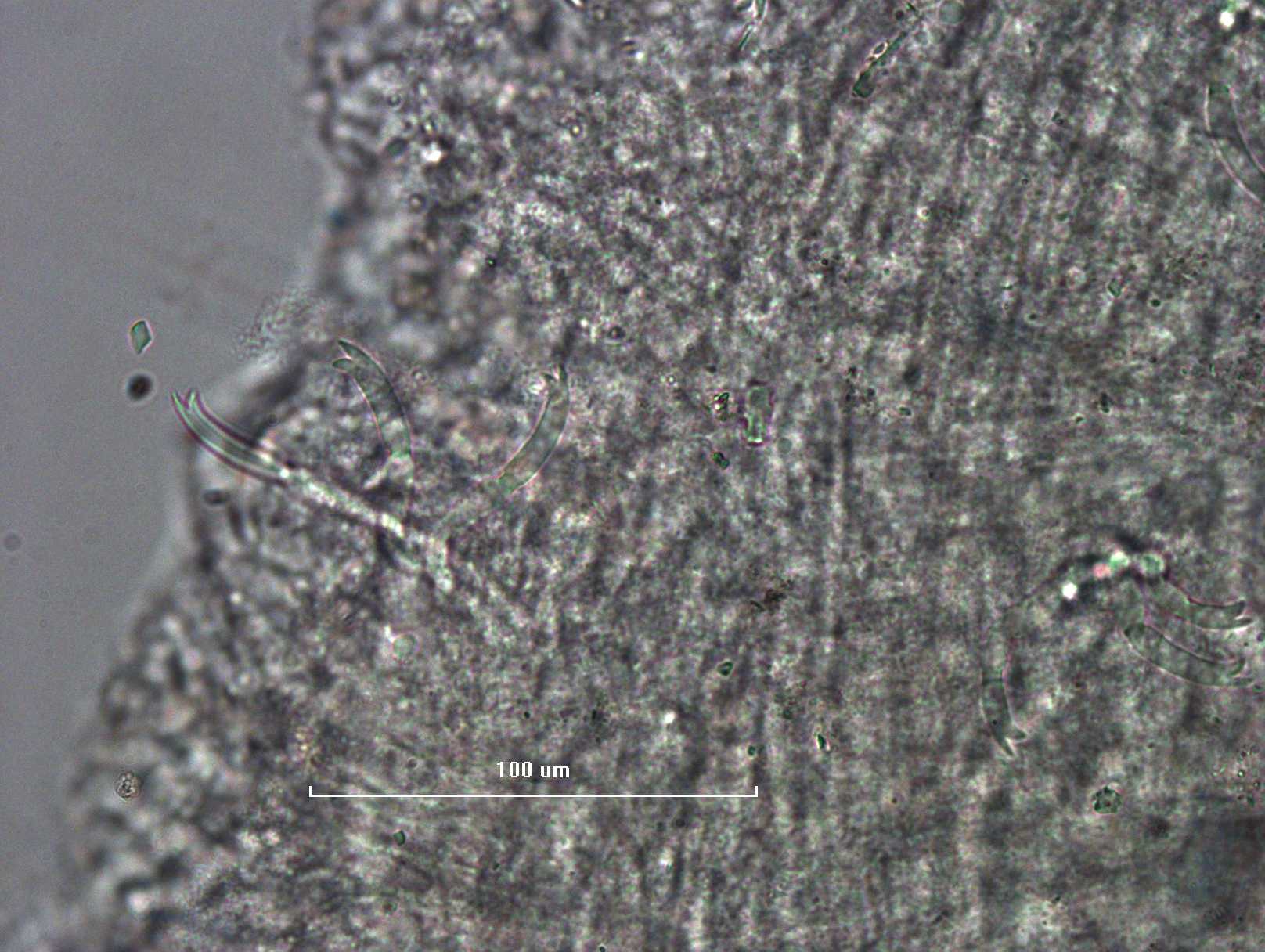 Photomicrograph of worm chaetae showing a set of chaetae with short, thick bifid teeth of equal length.