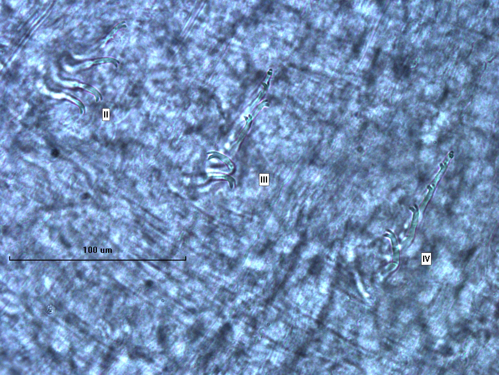 photomicrograph of the chaetae of a worm, which are bifid with the upper tooth shorter and thinner than the lower tooth. Bundles are labeled II, III, and IV.