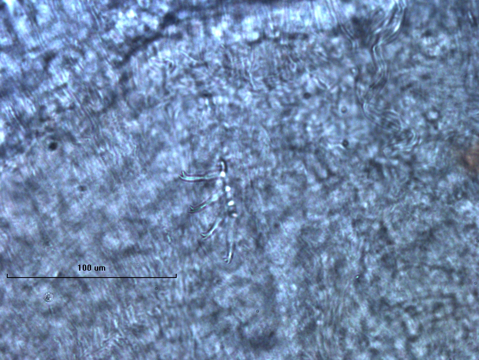photomicrograph of the chaetae of a worm, which are bifid with the upper tooth shorter and thinner than the lower tooth.