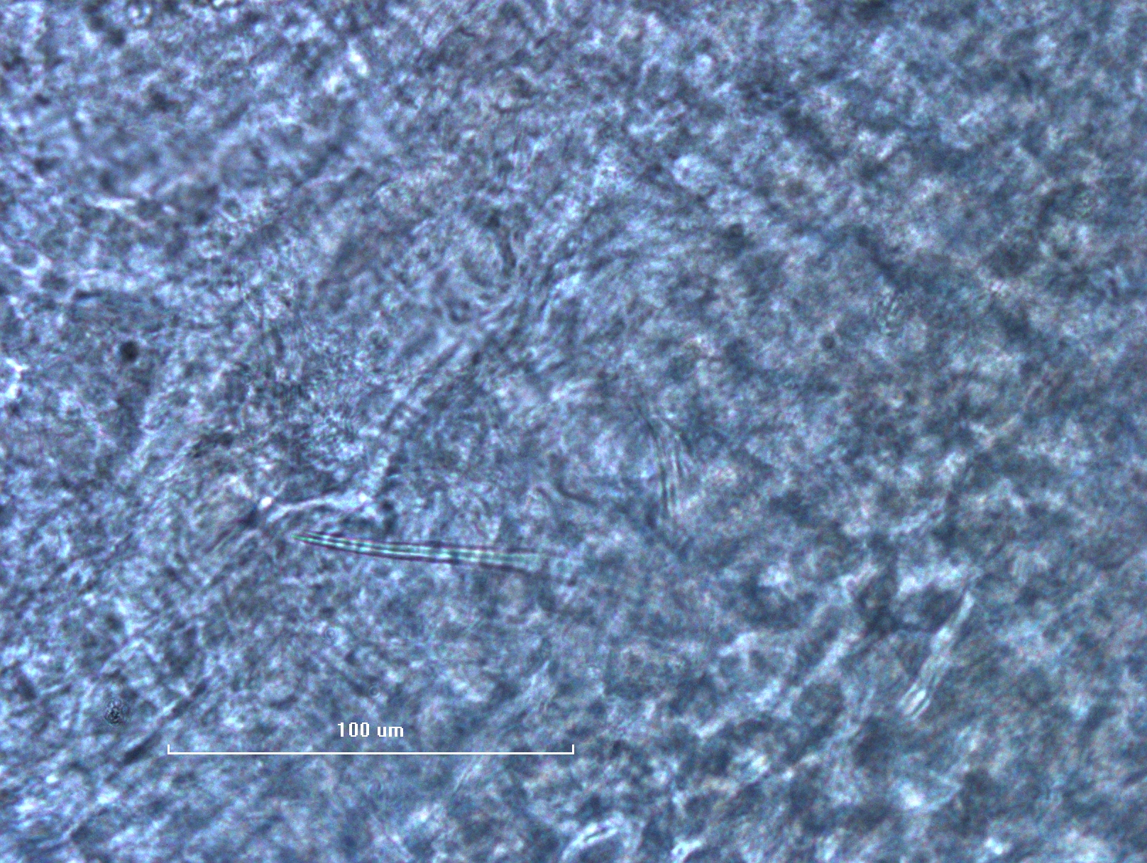 photomicrograph of the reproductive structure of a worm. The specialized chaetae is long and thin like a needle.