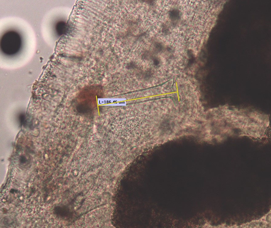 A microscope photo of the reproductive part of a worm. There is a penis sheath that is longer than it is wide with a flared end. There is a measurement bar that is labelled "L=186.46 µm."