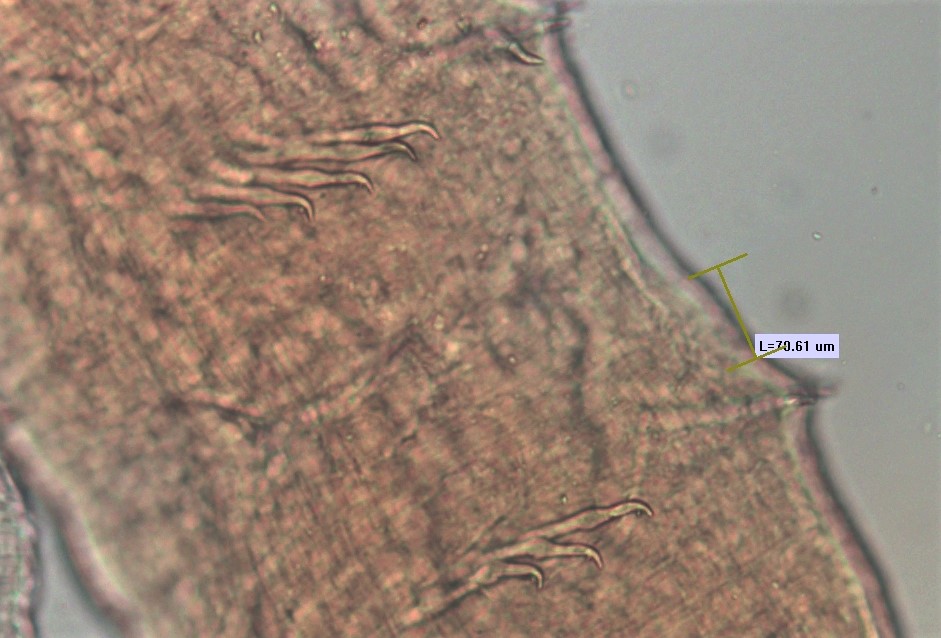 A microscope photo of a part of a worm showing the chaetae of several segments. The chaetae are bent up to 90° with the upper tooth more than twice as long as the very short lower tooth. There is a measurement bar not measuring a specific feature that is labelled "L=70.61 µm."