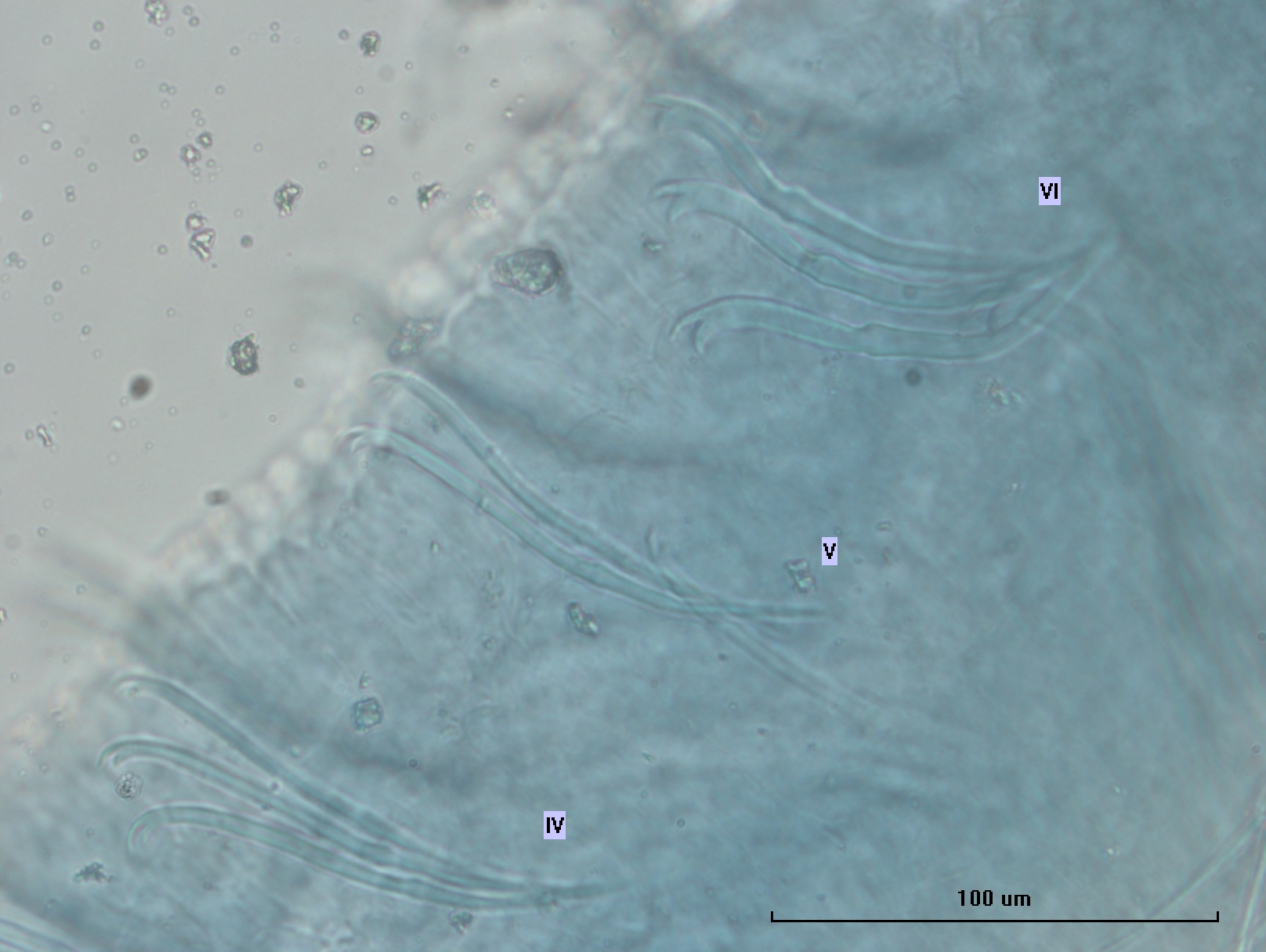 Photomicrograph of oligochaete worm features showing part of the body wall and many somatic hairs called chaetae. There are bundles of several chaetae in two rows. The chaetae switch from bifid (two teeth) with slightly long, thin upper teeth, to having short, thin upper teeth.