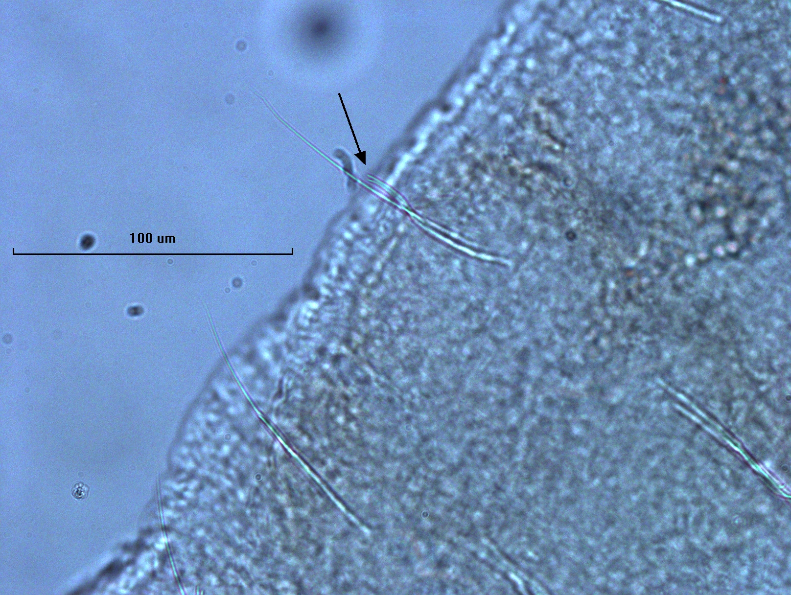 Photomicrograph of oligochaete worm features showing part of the body wall, a long hair chaetae, and a needle chaetae with two parallel teeth. Scale bar 100um.