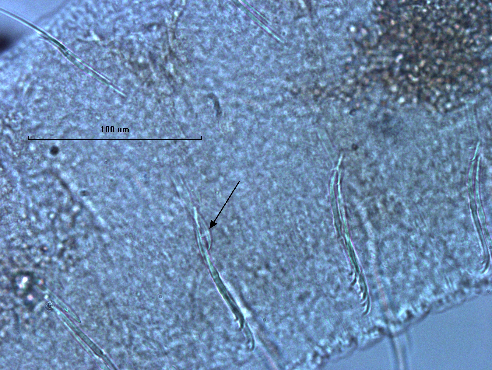 Photomicrograph of oligochaete worm features showing part of the body wall and many somatic hairs called chaetae. There are bundles of several chaetae in two rows. One bundle has an arrow pointing to a developing chaeta with a large upper tooth and tiny lower tooth