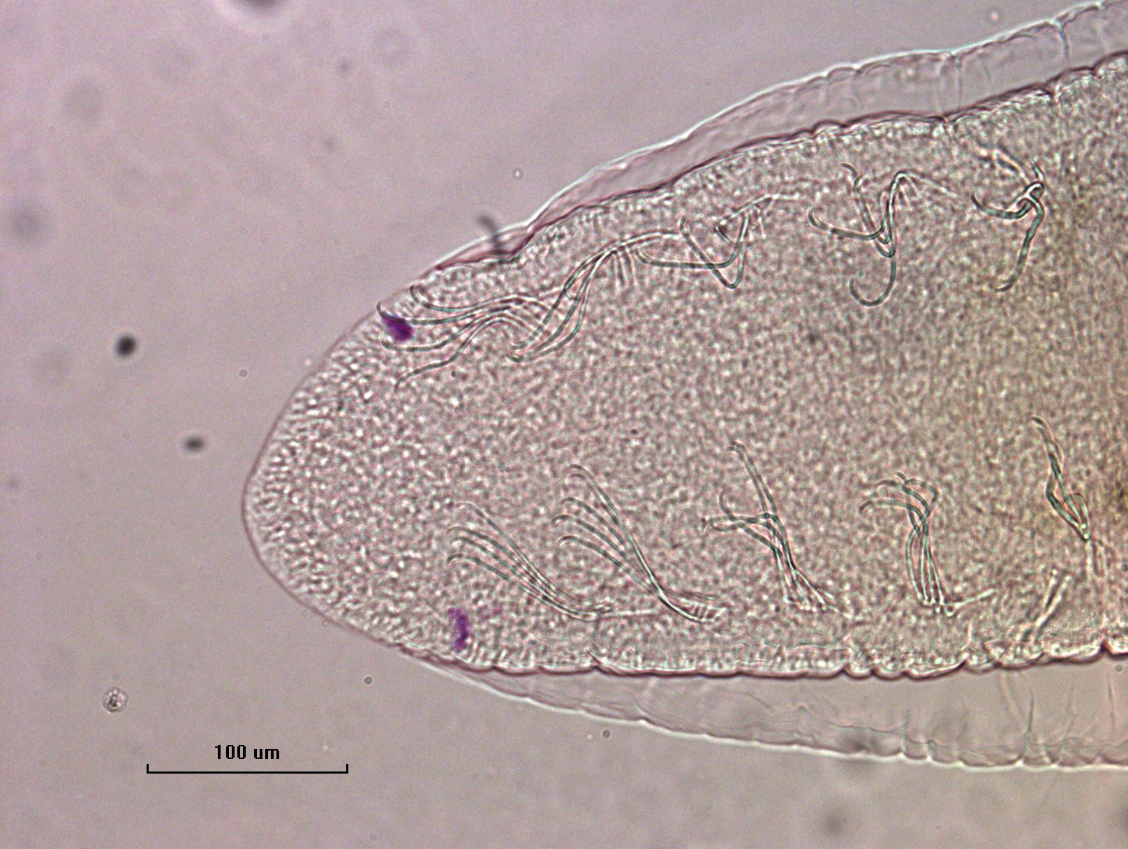 Photomicrograph of the head of an oligochaete worm showing two eyespots and two rows of bundles of somatic hairs (chaetae).