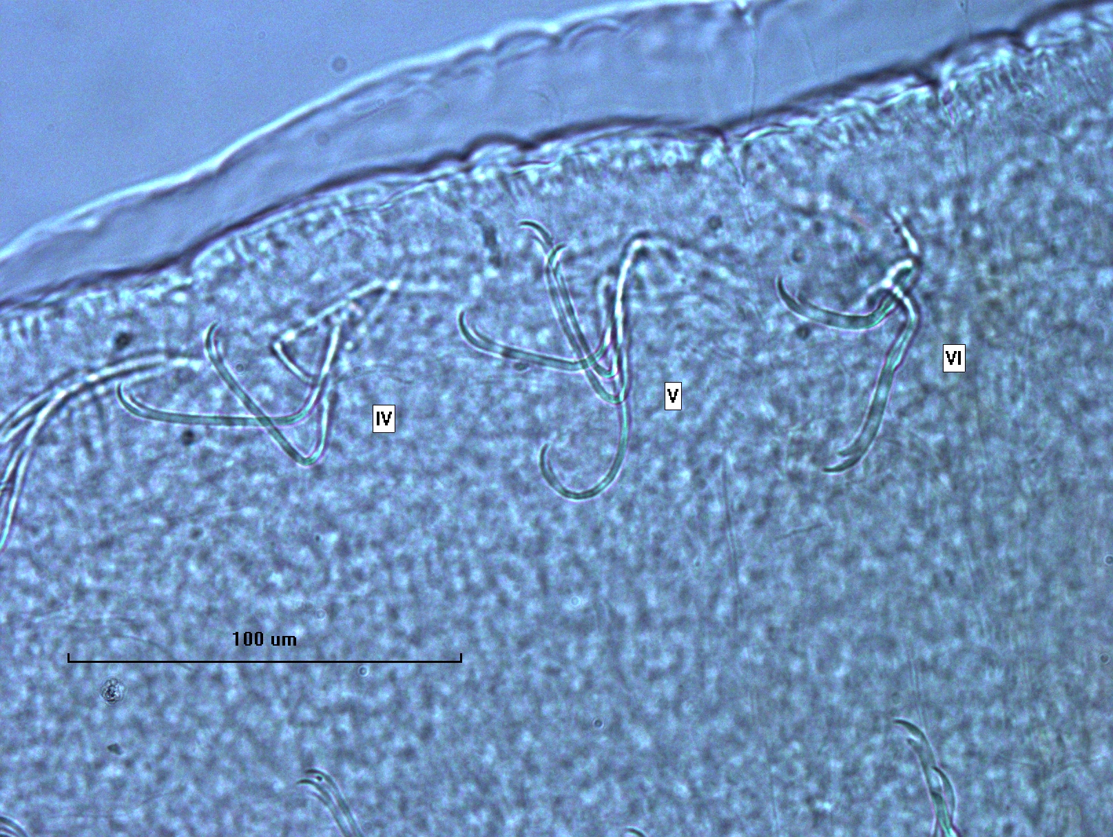 Photomicrograph of oligochaete worm features showing part of the body wall and many somatic hairs called chaetae. There are bundles of several chaetae in two rows. The chaetae switch from bifid (two teeth) with long, thin upper teeth twice as long as the lower, to having long, thick upper teeth twice as long as the lower.