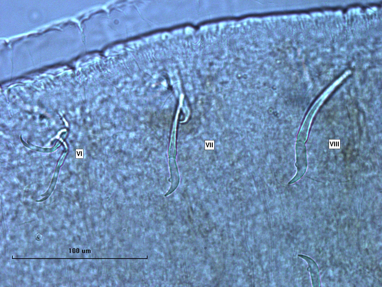 Photomicrograph of oligochaete worm features showing part of the body wall and many somatic hairs called chaetae. There are bundles of several chaetae in two rows. The chaetae switch from bifid (two teeth) with long, thick upper teeth, to having very large, thick upper teeth and a rudimentary lower tooth.