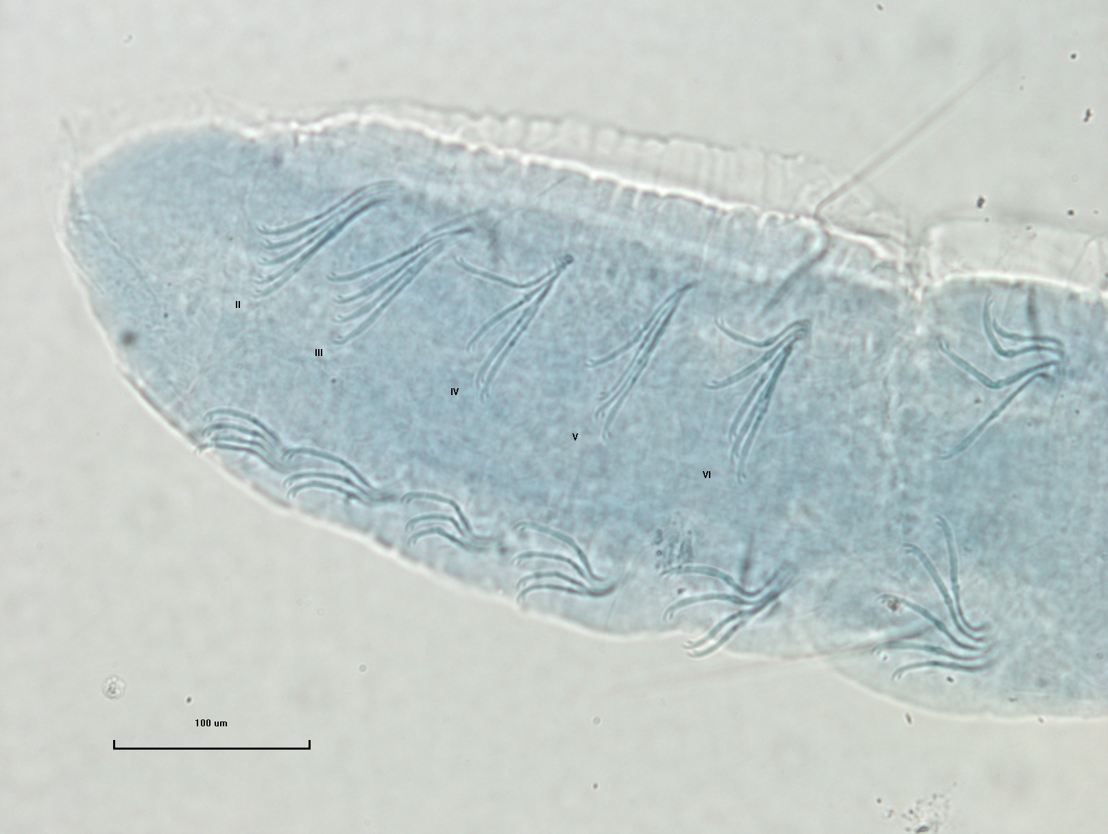 Photomicrograph of the head of an oligochaete worm showing two faint eyespots and two rows of bundles of somatic hairs (chaetae).