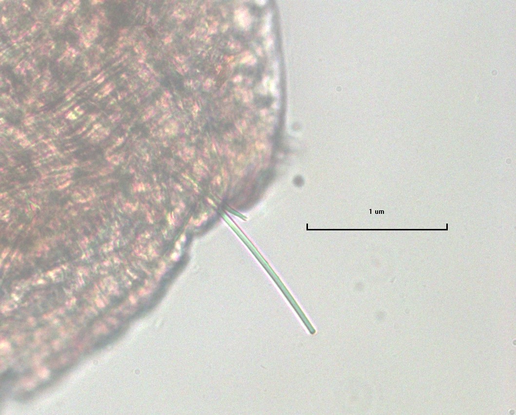 A microscope photo of a part of a worm with two segments with chaetae visible. There is a scale bar labeled 1 µm.