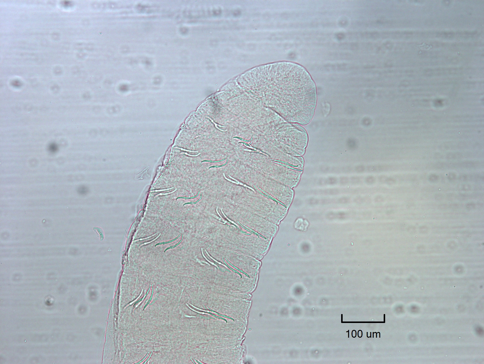 photomicrograph showing the front end of a worm with sets of two chaetae in each bundle