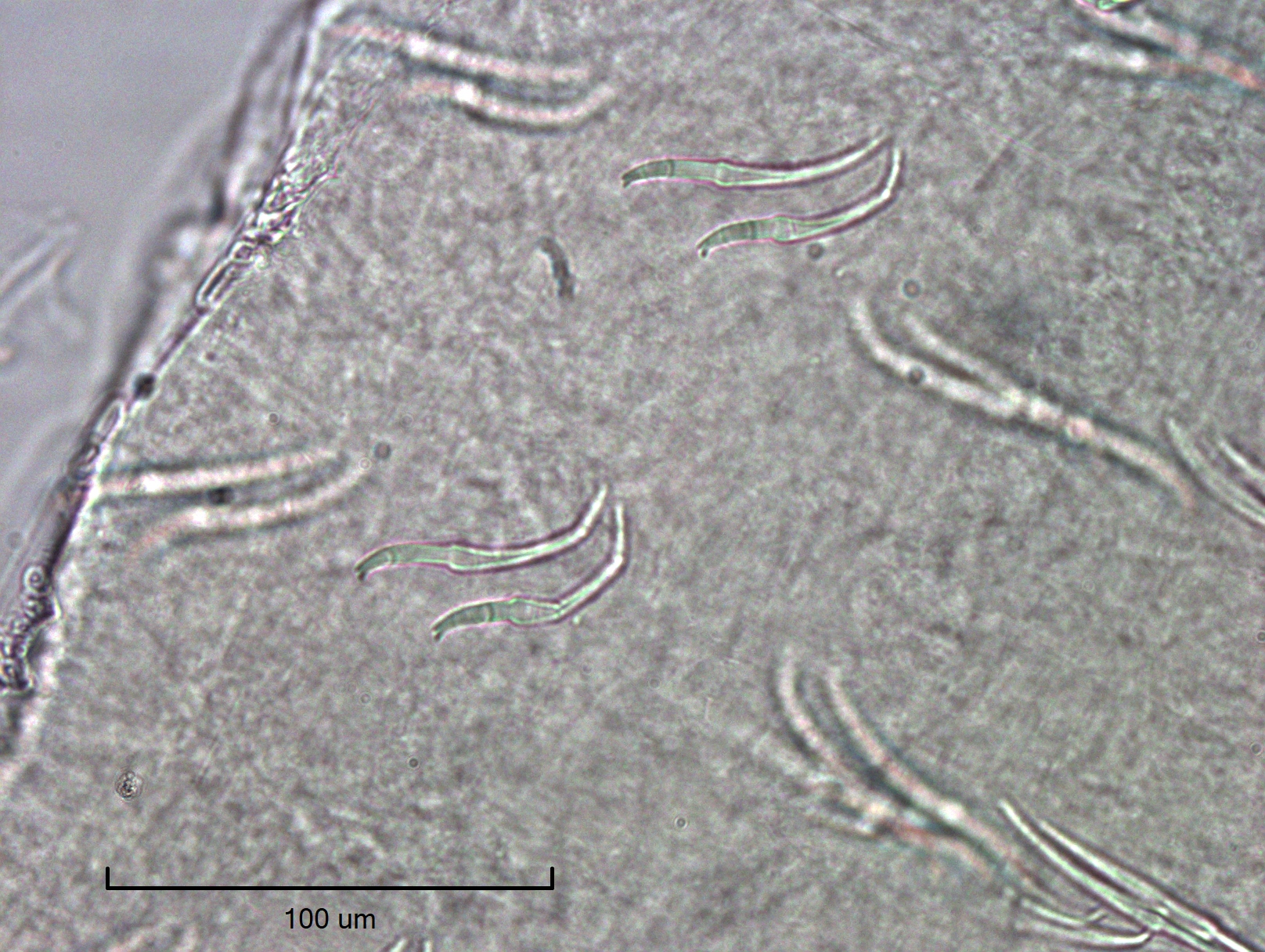 photomicrograph of sets of two worm hairs (chaetae) with the upper tooth much smaller than the lower tooth