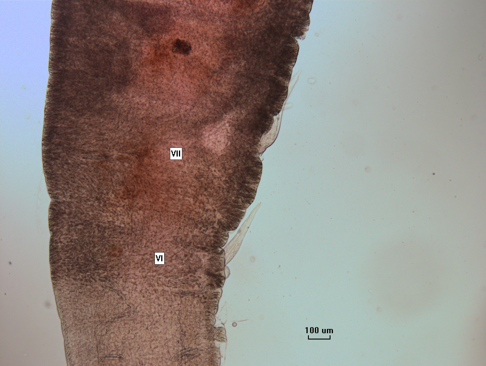 photomicrograph showing the clitellum of a worm with two sets of two reproductive structures protruding from the body and tapering to points