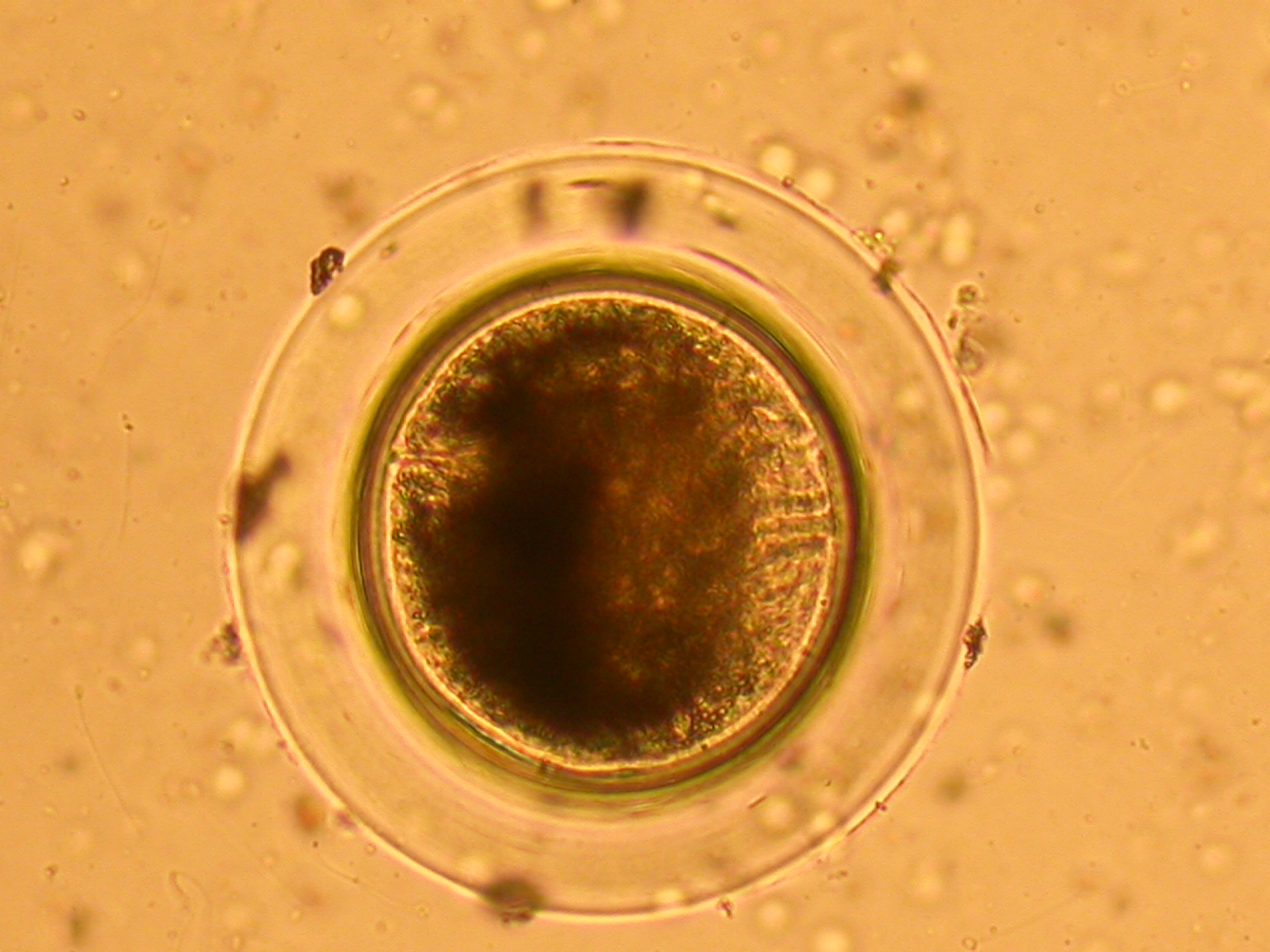 microscope picture of a single-celled organism that looks like an egg.